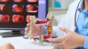 Gut-Health-Test-bowel-health-consultation