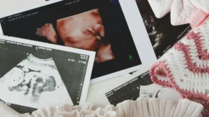 baby-scan-photos-world-maternal-mental-health-day-awareness